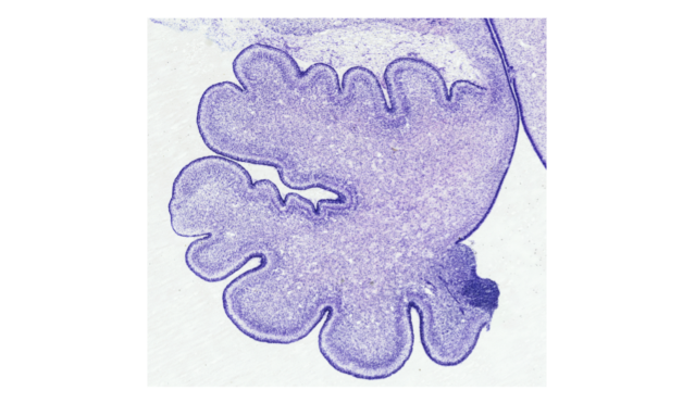 Image of a cerebellum.
