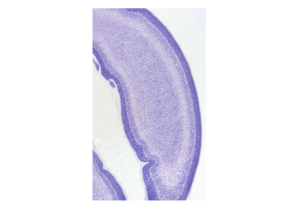 Image of the frontal cortex of the brain.
